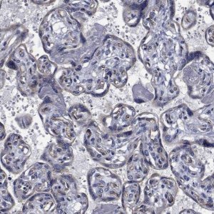 Anti-TTBK1 antibody produced in rabbit 