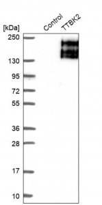 Anti-TTBK2 antibody produced in rabbit 