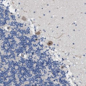 Anti-TWISTNB antibody produced in rabbit 