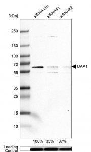 Anti-UAP1 antibody produced in rabbit 