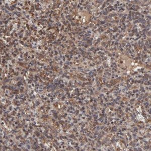 Anti-UBE2L6 antibody produced in rabbit 