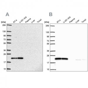 Anti-UBE2M antibody produced in rabbit HPA054551-100UL