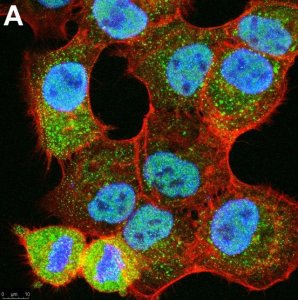 Anti-Ubiquitin K48-Specific Antibody, clone Apu2 ZooMAb� Rabbit Monoclonal 