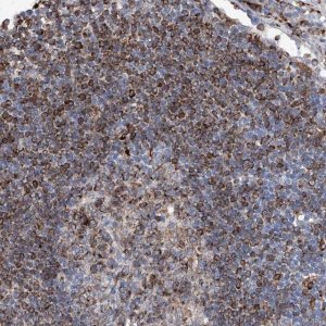 Anti-UBOX5 antibody produced in rabbit 