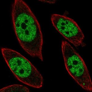 Anti-UBP1 antibody produced in rabbit HPA003967-100UL