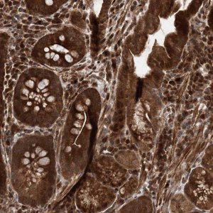 Anti-UBTD2 antibody produced in rabbit HPA035891-100UL