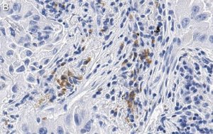 Anti-uPAR Antibody, clone 2G10 , ZooMAb� Rabbit Monoclonal 