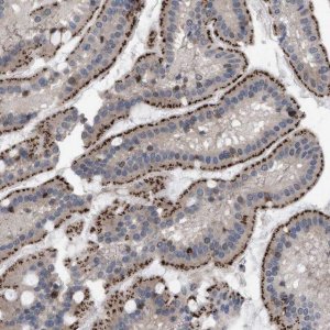 Anti-UPF1 antibody produced in rabbit 