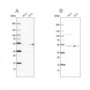Anti-UQCRC1 antibody produced in rabbit 