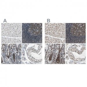 Anti-USP28 antibody produced in rabbit 