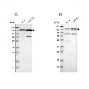 Anti-USP28 antibody produced in rabbit 
