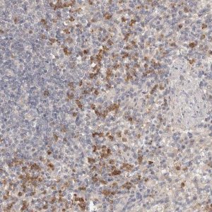 Anti-USP49 antibody produced in rabbit 