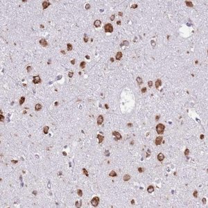 Anti-VARS antibody produced in rabbit 