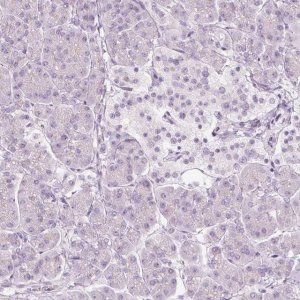 Anti-VCAM1 antibody produced in rabbit 