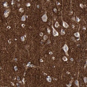 Anti-VCAN antibody produced in rabbit 