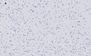 Anti-VGluT1 Antibody, clone 4O15, ZooMAb� Rabbit Monoclonal 