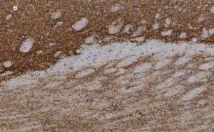 Anti-VGluT1 Antibody, clone 4O15, ZooMAb� Rabbit Monoclonal 