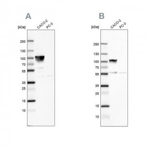 Anti-VIL1 antibody produced in rabbit 