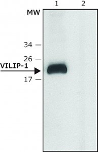Anti-VILIP-1 (C-terminal) antibody produced in rabbit 