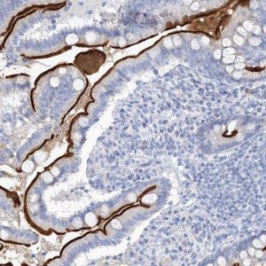 Anti-VILL antibody produced in rabbit 
