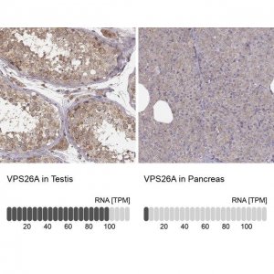 Anti-VPS26A antibody produced in rabbit HPA057498-100UL