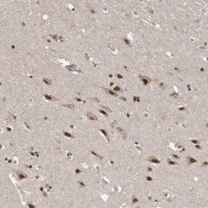 Anti-VPS37A antibody produced in rabbit 