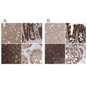 Anti-VPS37B antibody produced in rabbit HPA038218-100UL