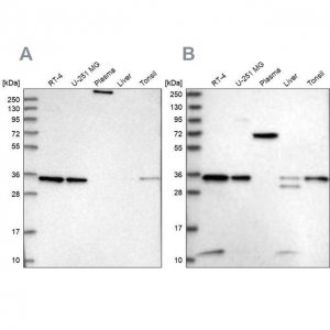 Anti-VPS37B antibody produced in rabbit HPA038218-100UL