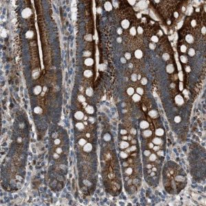 Anti-VPS41 antibody produced in rabbit HPA020080-100UL