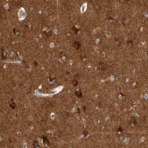 Anti-VPS53 antibody produced in rabbit 