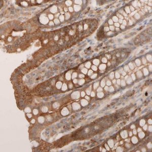 Anti-VSTM2A antibody produced in rabbit 