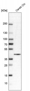 Anti-VSTM2A antibody produced in rabbit 