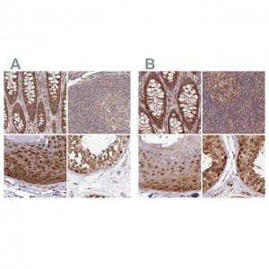 Anti-WAPL antibody produced in rabbit 