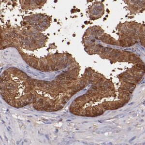 Anti-WASHC1 antibody produced in rabbit 