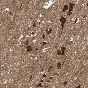 Anti-WASL antibody produced in rabbit 