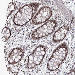 Anti-WBP1L antibody produced in rabbit HPA038371-100UL