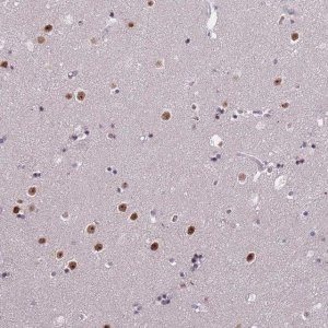 Anti-WDR18 antibody produced in rabbit HPA050193-100UL