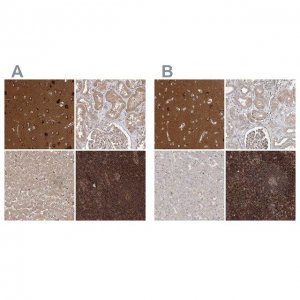 Anti-WDR37 antibody produced in rabbit 