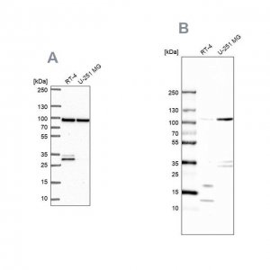 Anti-WDR48 antibody produced in rabbit 