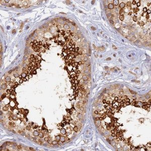 Anti-WDR62 antibody produced in rabbit 