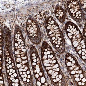 Anti-WDR73 antibody produced in rabbit 
