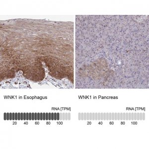 Anti-WNK1 antibody produced in rabbit 