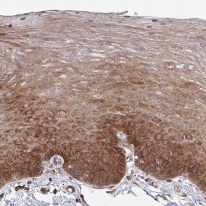 Anti-WNK1 antibody produced in rabbit 