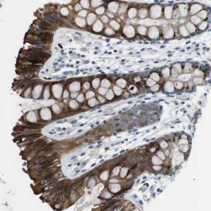 Anti-WSCD1 antibody produced in rabbit 