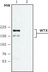Anti-WTX (C-terminal) antibody produced in rabbit 
