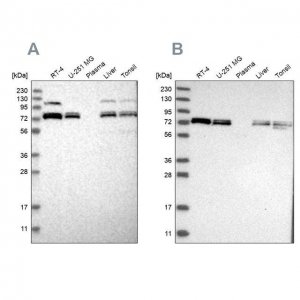Anti-XPNPEP1 antibody produced in rabbit 