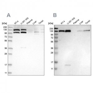 Anti-XPO5 antibody produced in rabbit 