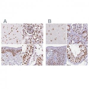 Anti-XRCC6 antibody produced in rabbit 