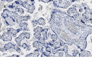 Anti-YAP1 Antibody, clone 4F22, ZooMAb� Rabbit Monoclonal 