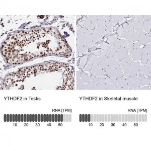 Anti-YTHDF2 antibody produced in rabbit 